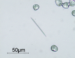 シュウ酸カルシウムの針状結晶の顕微鏡写真