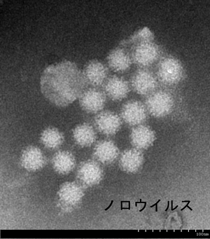 ノロウイルスの電子顕微鏡像