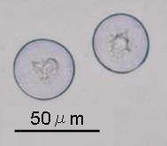 ヒノキ花粉の写真