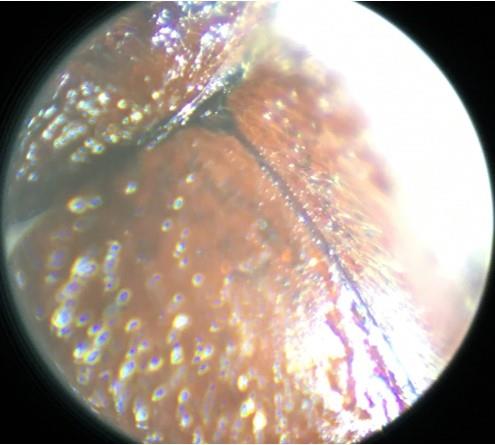 シバンムシ顕微鏡背中