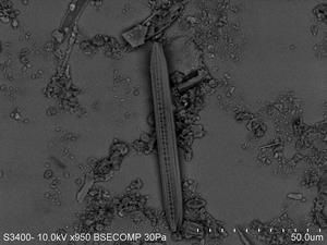 Bacillaria属電子顕微鏡写真