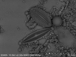 Navicula属、Cocconeis属電子顕微鏡写真