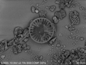 Cyclotella属電子顕微鏡写真