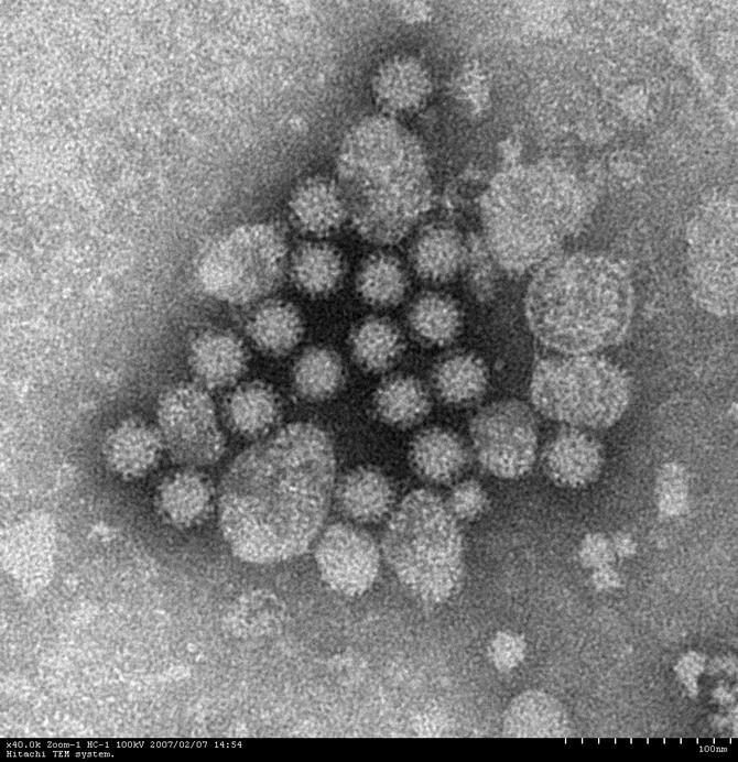 ノロウイルスの写真1