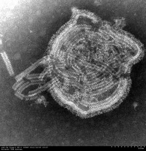ヌクレオカプシドが飛び出したパラインフルエンザウイルス
