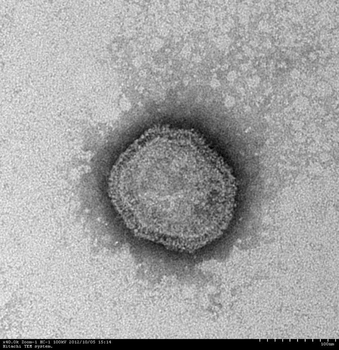 パラインフルエンザウイルスの写真