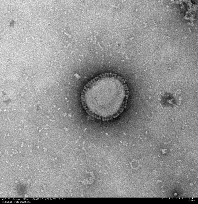 インフルエンザウイルスの写真