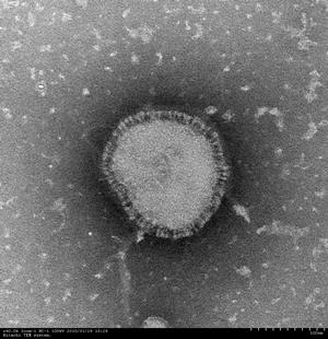 RSウイルスの写真1