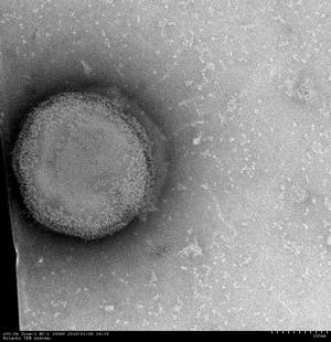 ムンプスウイルスの写真1
