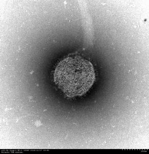ムンプスウイルスの写真2