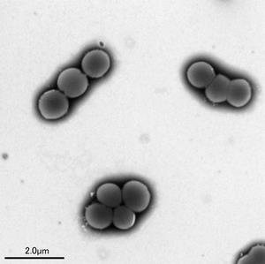 A群溶血性レンサ球菌の写真