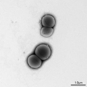 A群溶血性レンサ球菌の写真