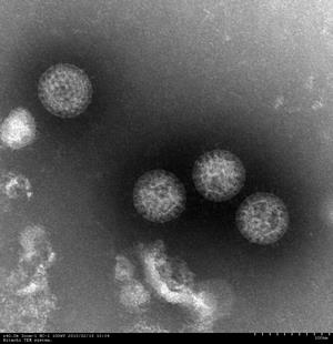 ロタウイルスの写真