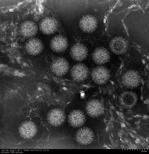 ロタウイルスの写真2